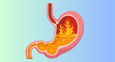 How to Get Rid of Heartburn: Effective Remedies and Prevention Tips