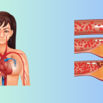 7 Signs That Indicate Clogged Arteries