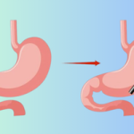 6 Indices and Manifestations of Gastric Cancer